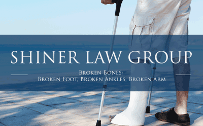Broken Bones: Broken Foot, Broken Ankles, Broken Arm