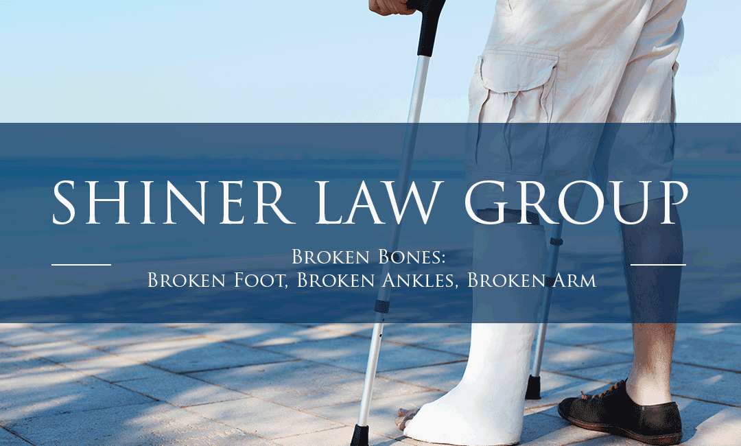Broken Bones: Broken Foot, Broken Ankles, Broken Arm