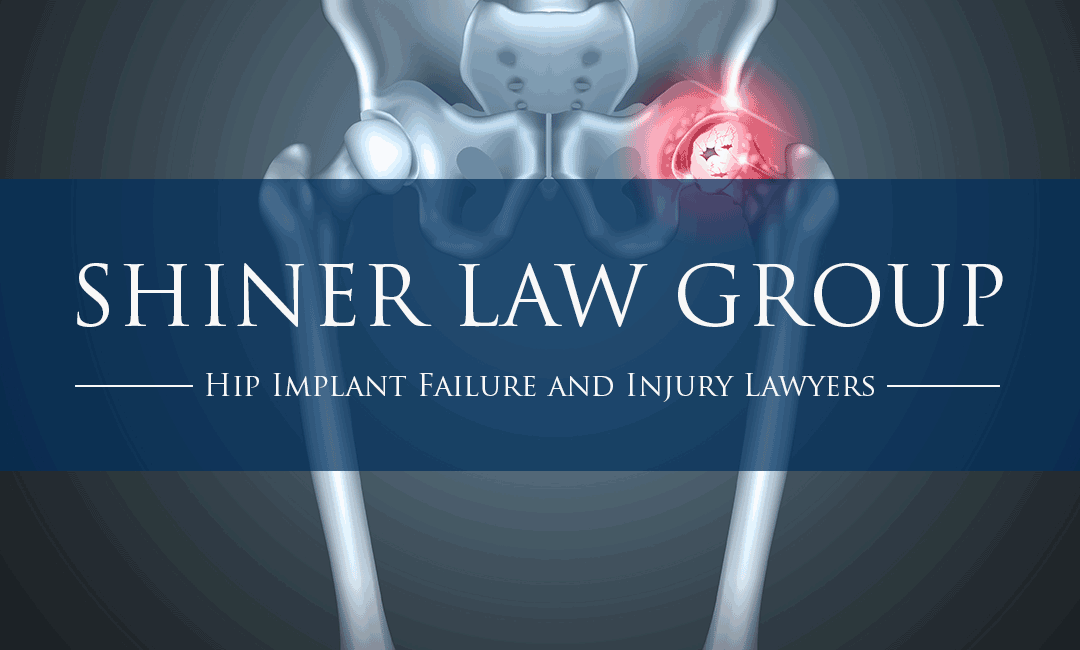 Florida Hip Implant Failure and Injury Lawyers