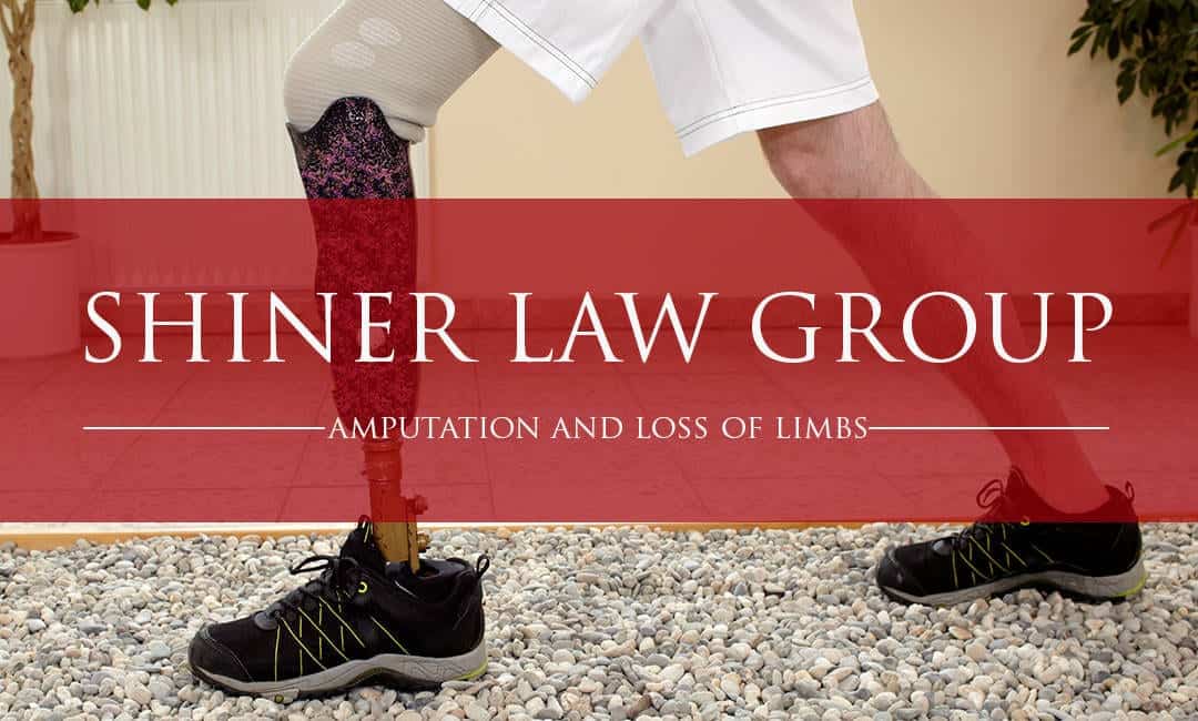 Amputation and Loss of Limbs