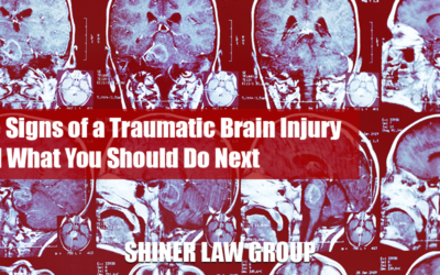 The Signs of a Traumatic Brain Injury and What You Should Do Next