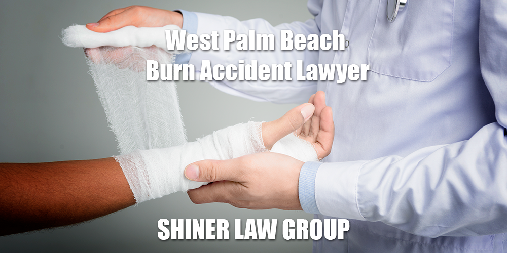 West Palm Beach Burn Accident Lawyer