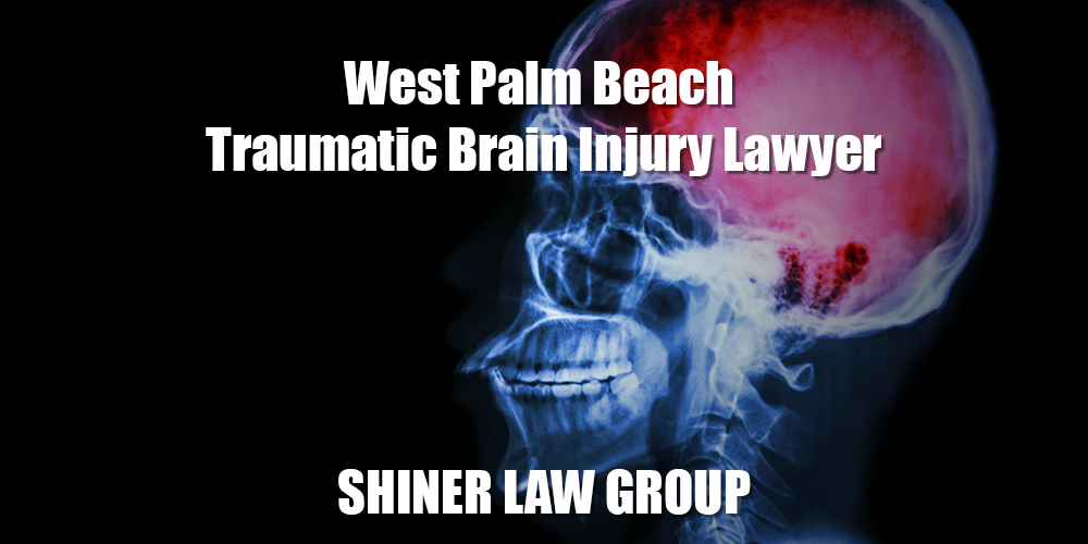 West Palm Beach Traumatic Brain Injury Lawyers