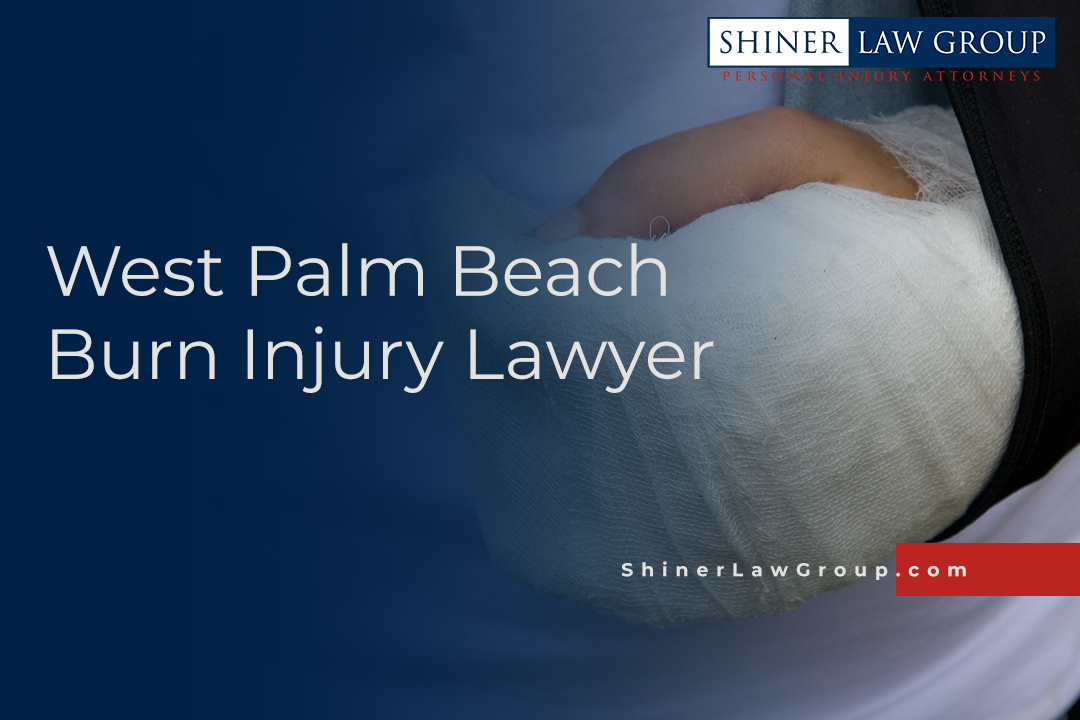 Burn Injury Lawyer West Palm Beach