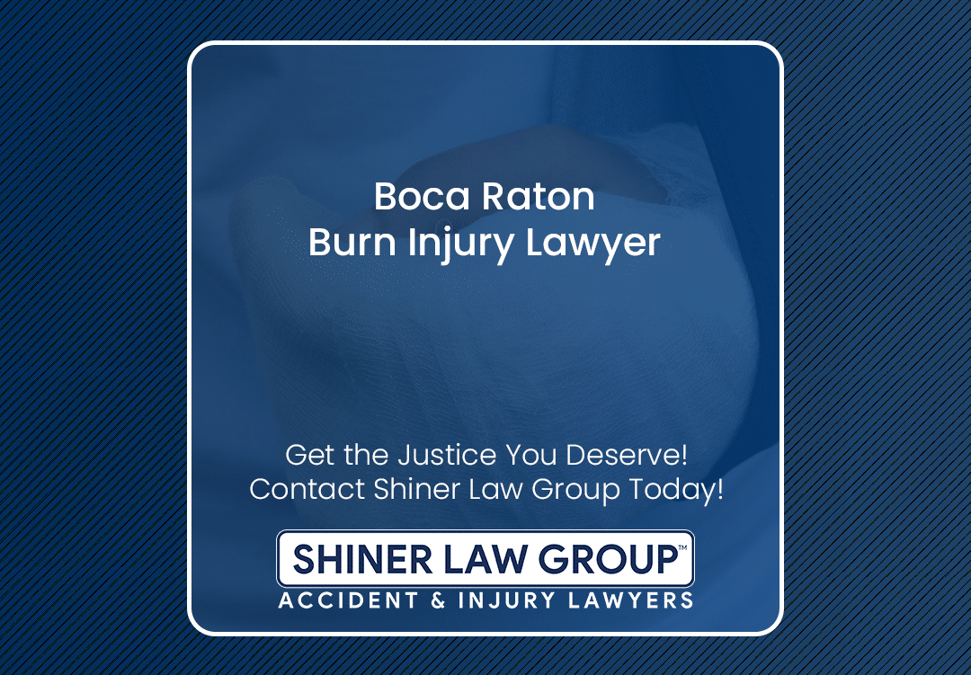 Boca Raton Burn Injury Lawyer